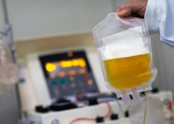 پالایشگاه پلاسما چیست و چه کاربردی دارد؟