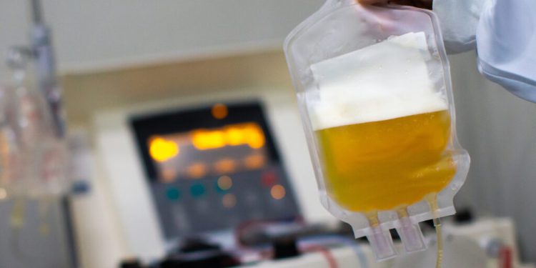 پالایشگاه پلاسما چیست و چه کاربردی دارد؟