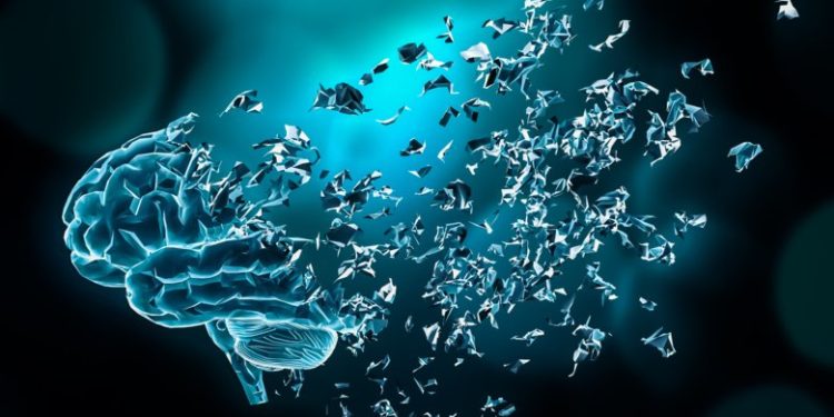 آلزایمر چیست ؟